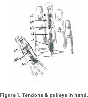 A diagram of the Tendons and Pulleys in a Hand